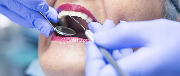Best Broken or Cracked Tooth Emergency Dentist in Crossville, AL
